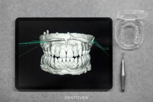 Orthodontia Services - Dentovex